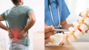 Is It Just Back Pain, or a Slipped Disc? Know the Key Differences