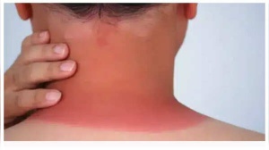 Skin Cancer: Don't Ignore These 5 Early Warning Signs
Hoặc:
Spotting Skin Cancer Early: 5 Subtle Signs You Shouldn't Overlook