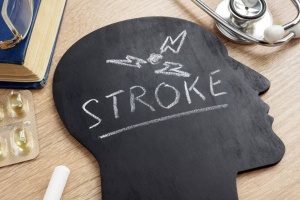 Brain Stroke: How to Spot the Warning Signs and Slash Your Risk