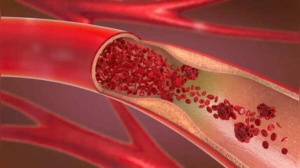 Doctor Reveals 5 Natural Strategies for Stronger, Healthier Arteries