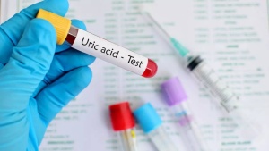 5 Diet and Exercise Strategies to Lower Uric Acid Levels in One Month