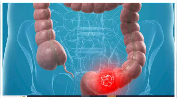 Illustration of abdominal pain