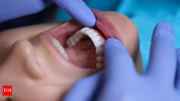 Common oral cancer symptoms