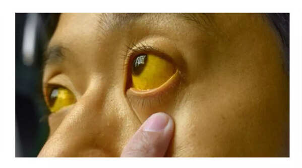 Pale or yellowish skin