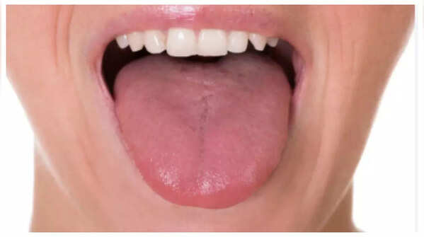 Swollen or sore tongue