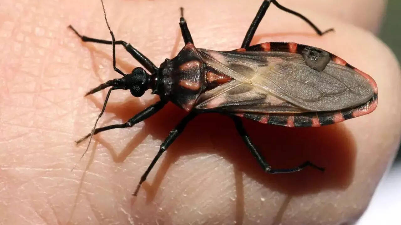 Chagas disease (2)