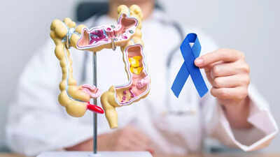 Colon cancer doctor shares five life-saving lessons: Symptoms and risks you should know