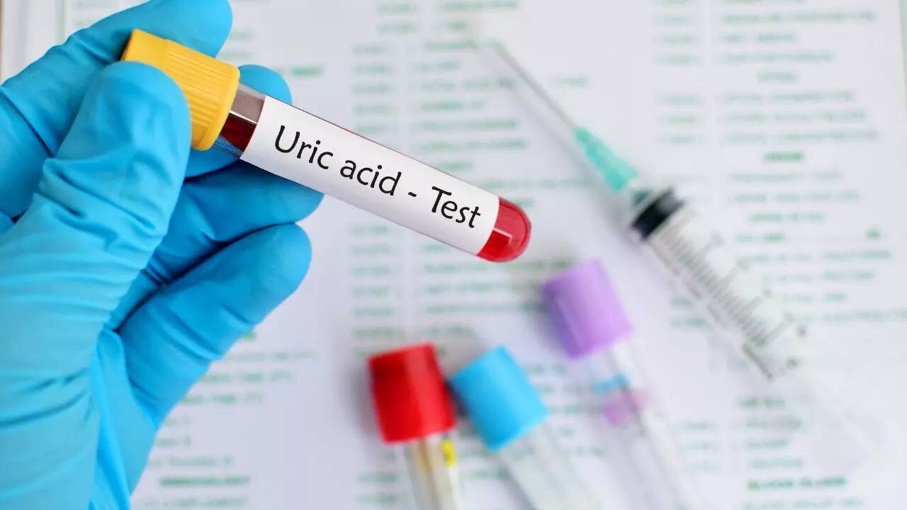 Subtle signs of high uric acid